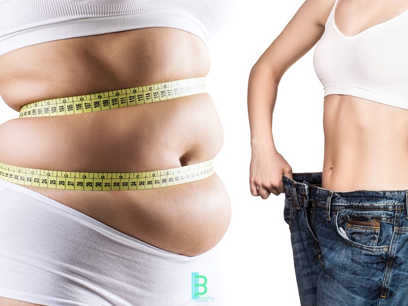 What are Obesity Surgery and Treatment Methods?